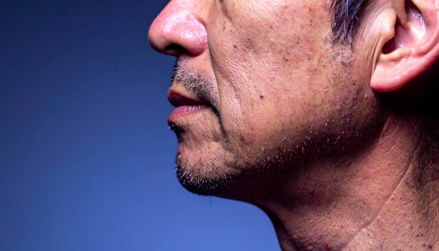 老け見え撃退！40代男のほうれい線の原因と薄くする3つの対策を徹底解説